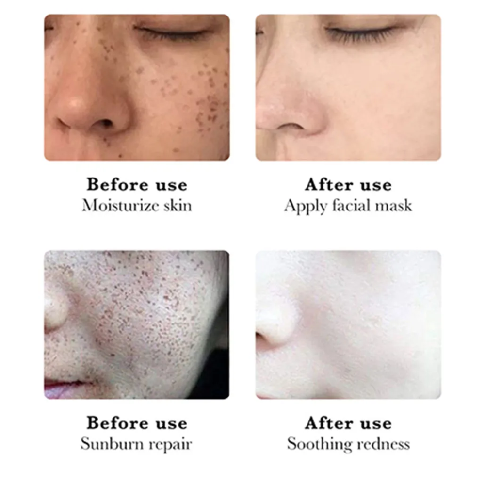 Serum Blanqueador Aclarante quita mancha